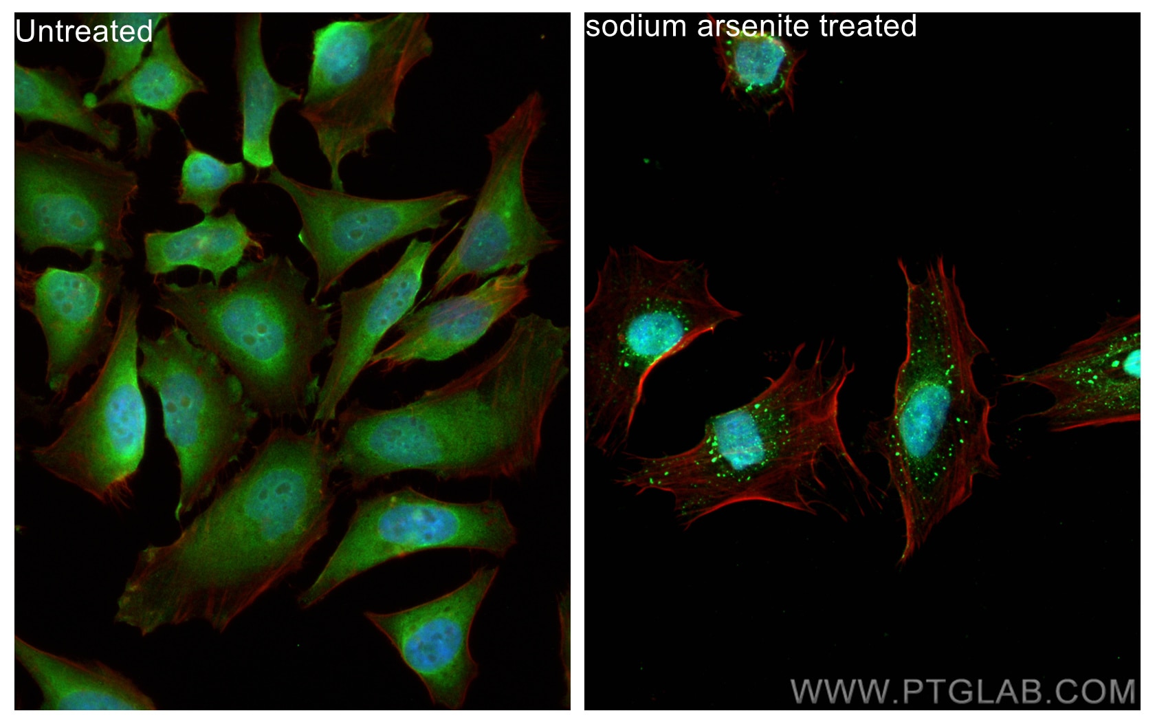 Immunofluorescence (IF) / fluorescent staining of HeLa cells using CoraLite® Plus 488-conjugated G3BP2 Polyclonal ant (CL488-16276)