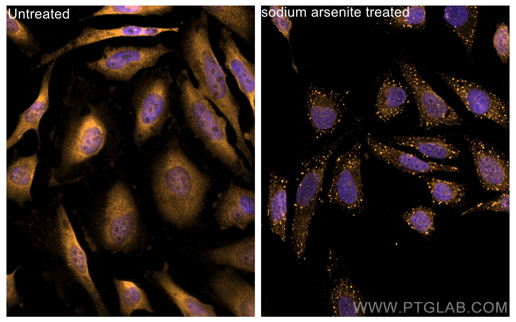 Immunofluorescence (IF) / fluorescent staining of HeLa cells using CoraLite®555-conjugated G3BP2 Polyclonal antibody (CL555-16276)