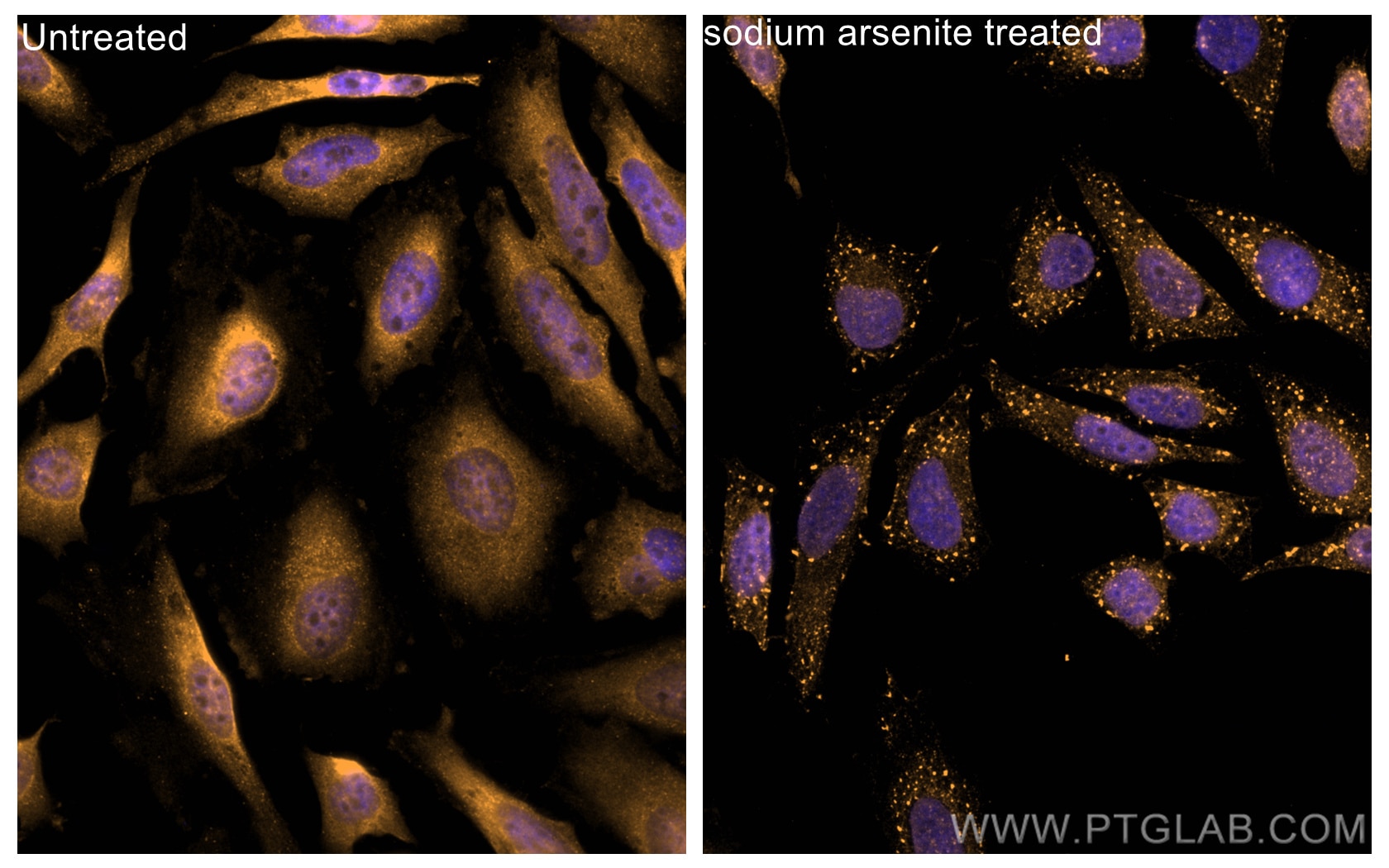 IF Staining of HeLa using CL555-16276