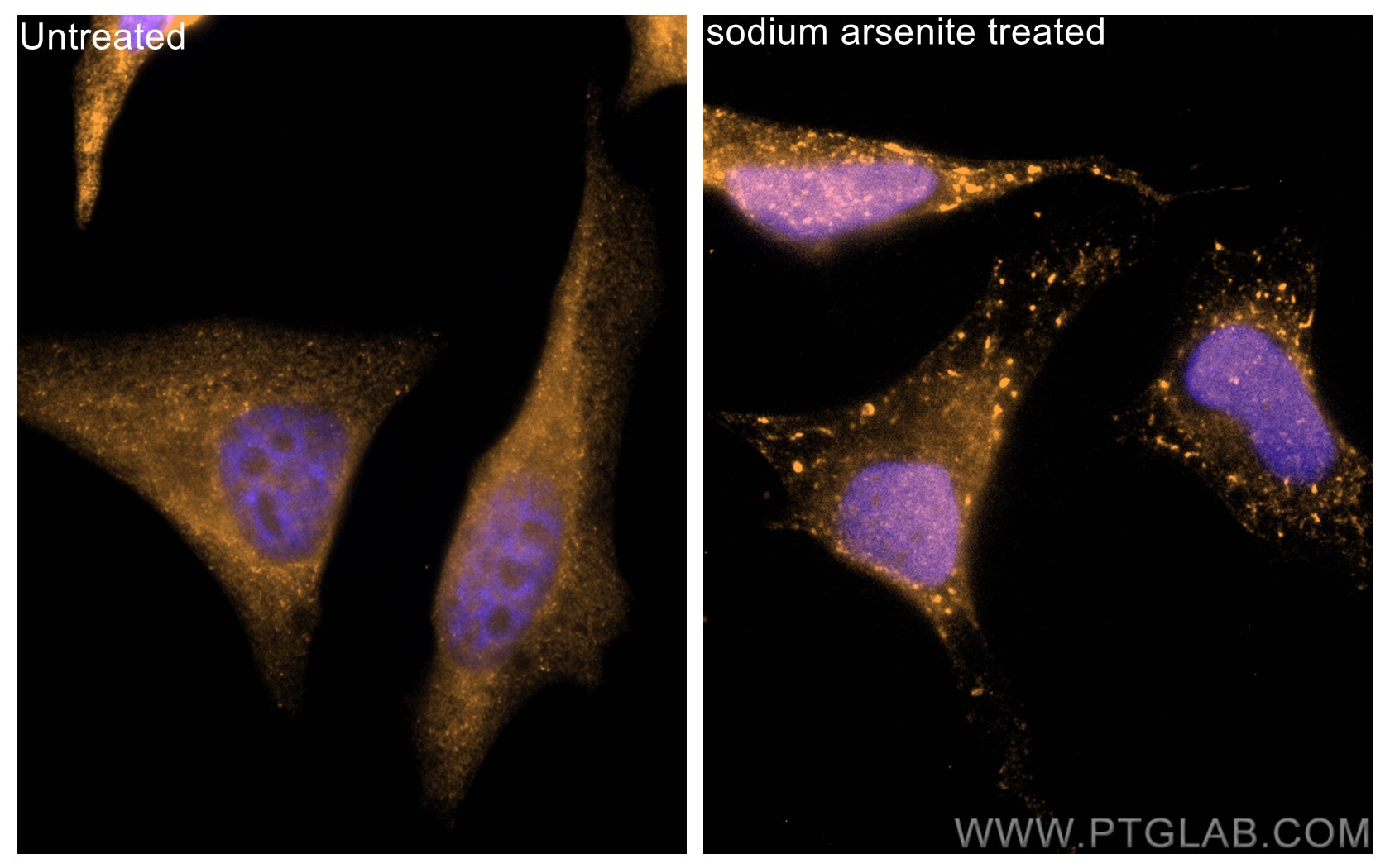 Immunofluorescence (IF) / fluorescent staining of HeLa cells using CoraLite®555-conjugated G3BP2 Polyclonal antibody (CL555-16276)