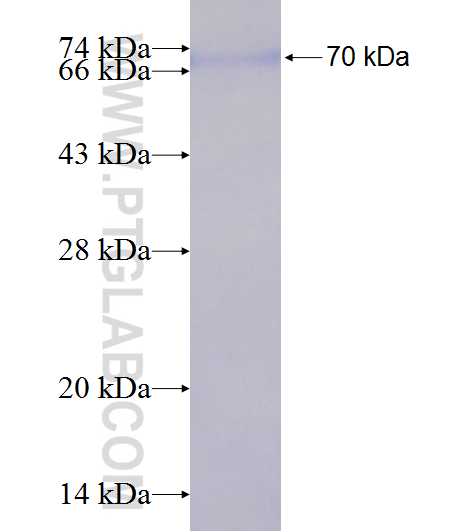 G3BP2 fusion protein Ag9355 SDS-PAGE
