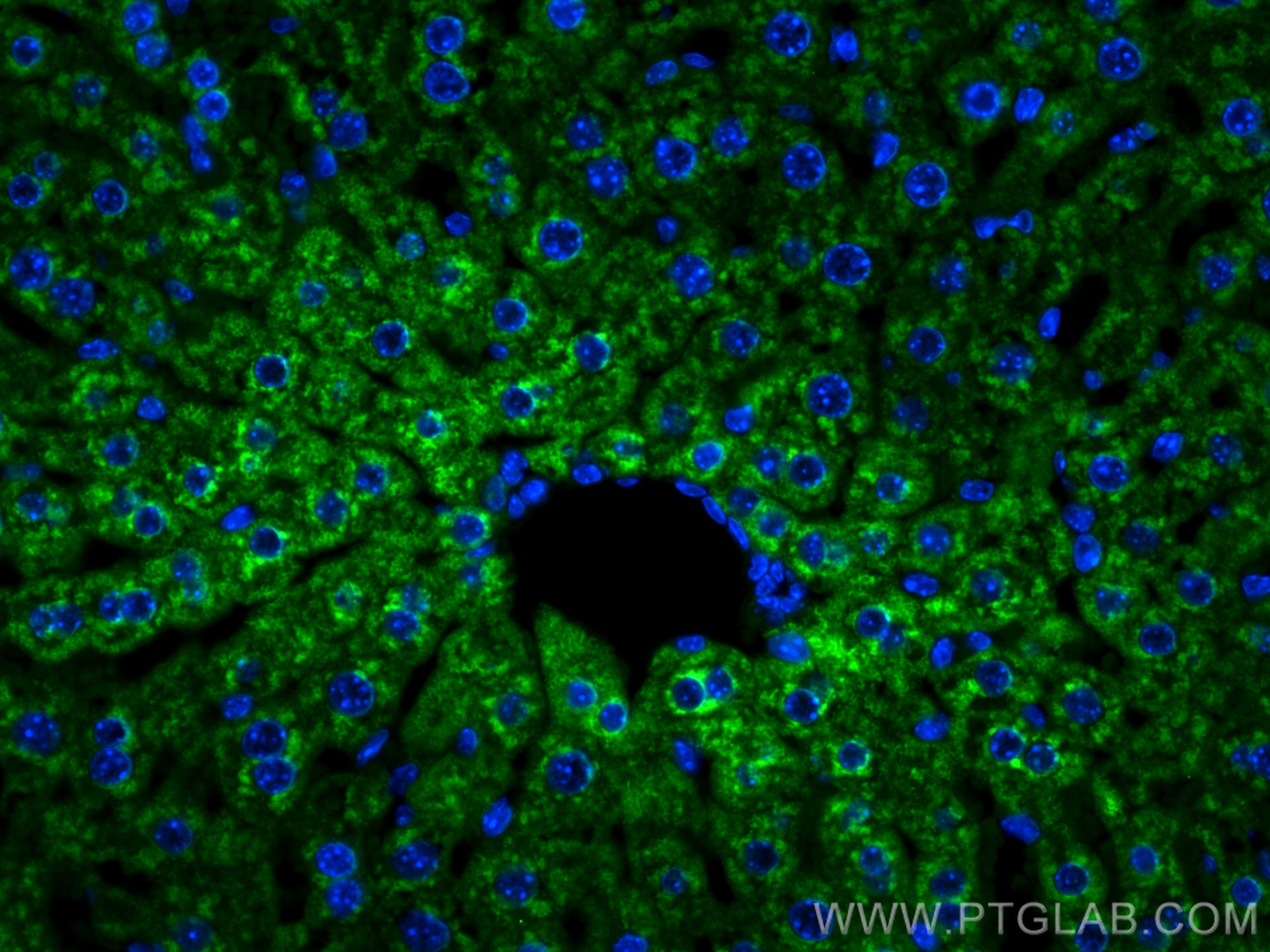 Immunofluorescence (IF) / fluorescent staining of mouse liver tissue using G6PC Polyclonal antibody (22169-1-AP)