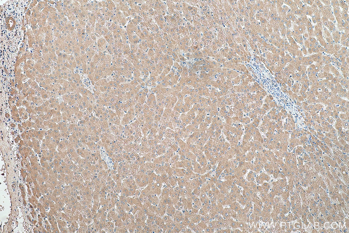 Immunohistochemistry (IHC) staining of human liver tissue using G6PC Polyclonal antibody (22169-1-AP)