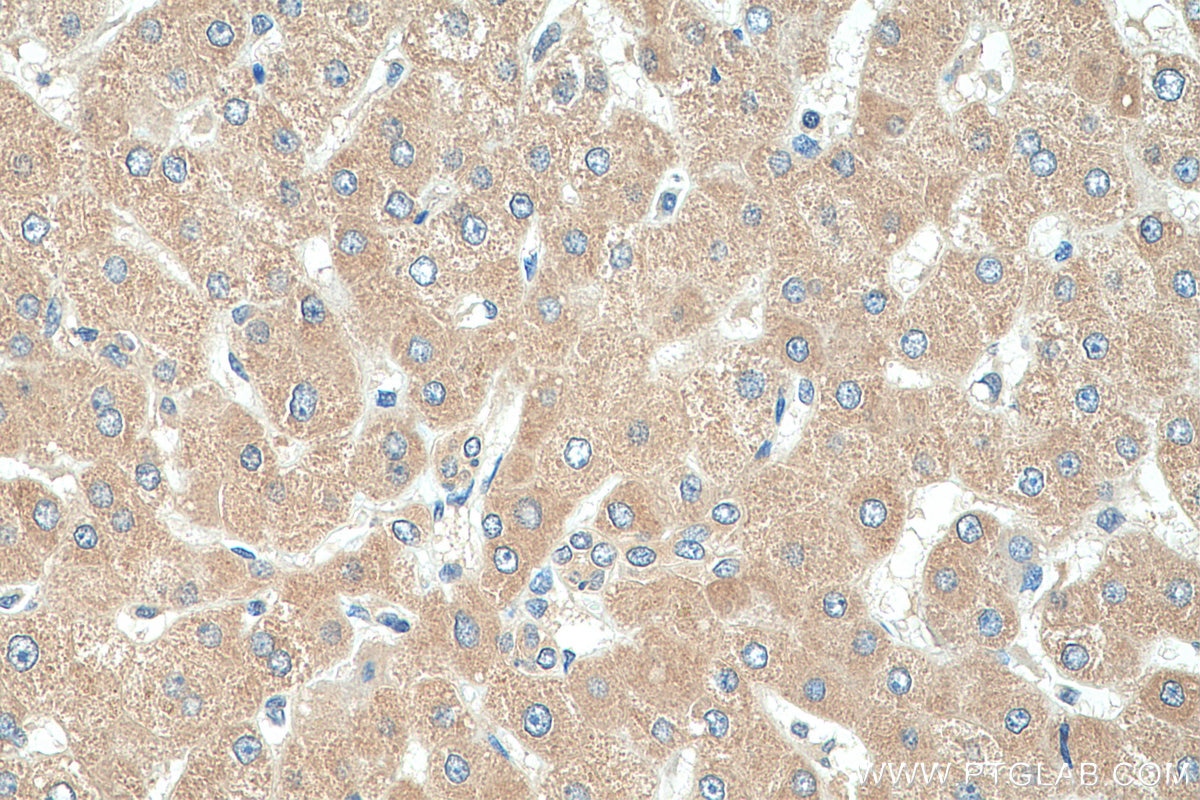 Immunohistochemistry (IHC) staining of human liver tissue using G6PC Polyclonal antibody (22169-1-AP)