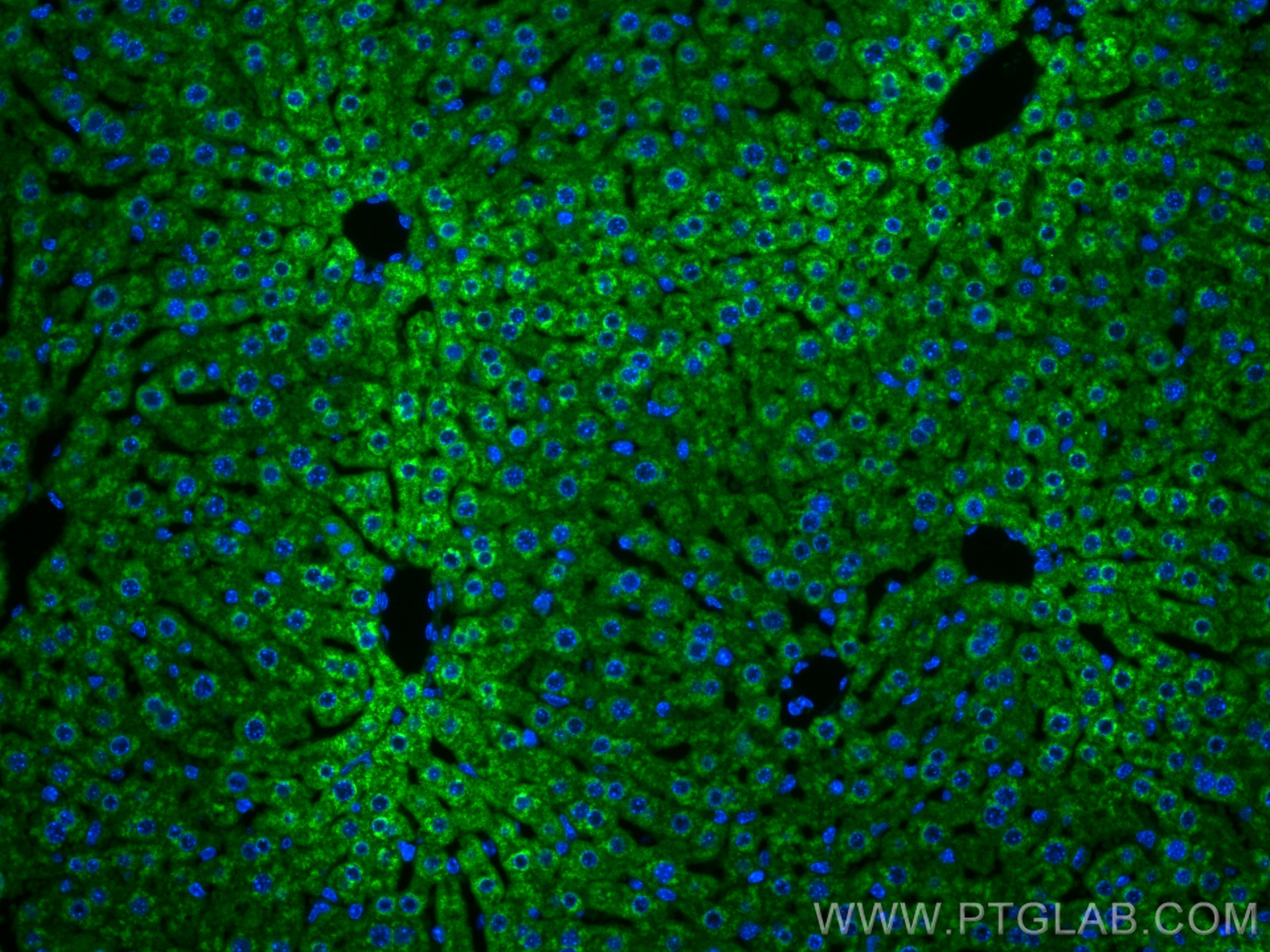 IF Staining of mouse liver using 25771-1-AP Immunofluorescence (IF) / fluorescent staining of mouse liver tissue using G6PC Polyclonal antibody (25771-1-AP)
