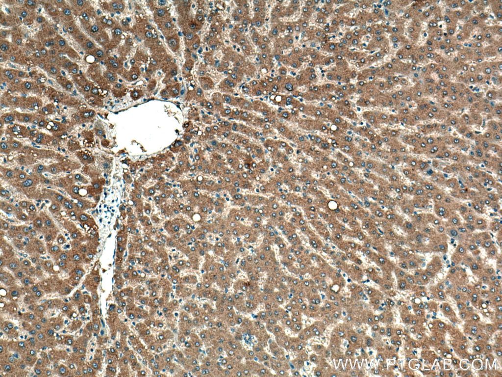 Immunohistochemistry (IHC) staining of human liver tissue using G6PC Monoclonal antibody (66860-1-Ig)