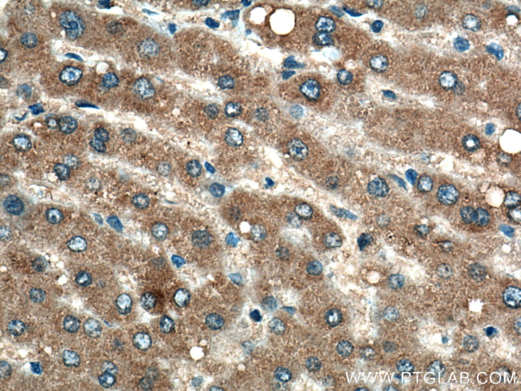 Immunohistochemistry (IHC) staining of human liver tissue using G6PC Monoclonal antibody (66860-1-Ig)