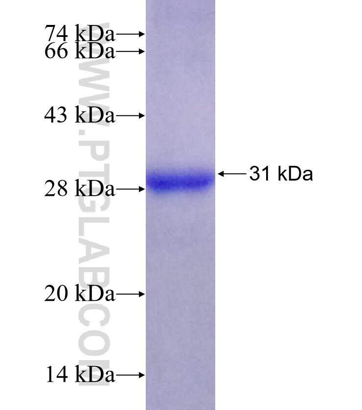 G6PC fusion protein Ag17839 SDS-PAGE