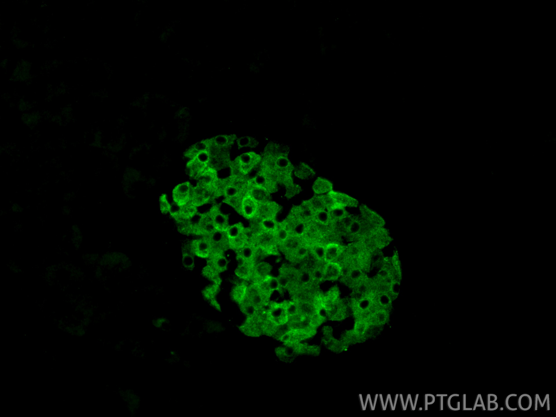 Immunofluorescent analysis of (4% PFA) fixed paraffin-embedded mouse pancreas tissue using G6PC2 antibody (18074-1-AP) at dilution of 1:200 and CoraLite®488-Conjugated Goat Anti-Rabbit IgG(H+L) (SA00013-2). Heat mediated antigen retrieval with Tris-EDTA buffer (pH 9.0). Immunofluorescence (IF) / fluorescent staining of mouse pancreas tissue using G6PC2 Polyclonal antibody (18074-1-AP)