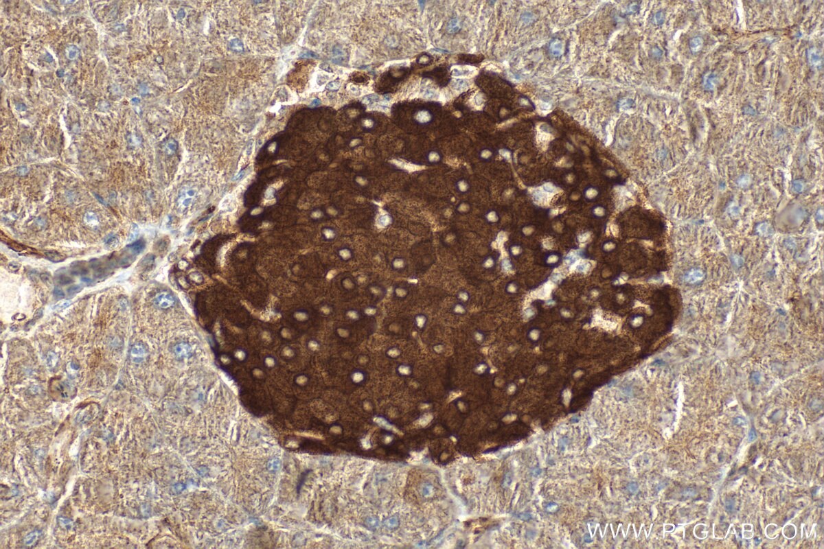Immunohistochemical analysis of paraffin-embedded mouse pancreas tissue slide using 18074-1-AP (G6PC2 antibody) at dilution of 1:200 (under 40x lens). Heat mediated antigen retrieval with Tris-EDTA buffer (pH 9.0). Immunohistochemistry (IHC) staining of mouse pancreas tissue using G6PC2 Polyclonal antibody (18074-1-AP)