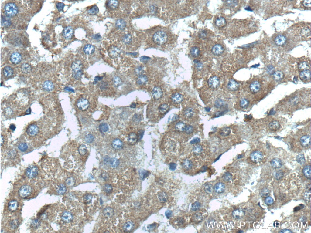 Immunohistochemistry (IHC) staining of human liver tissue using G6PC3 Polyclonal antibody (23967-1-AP)