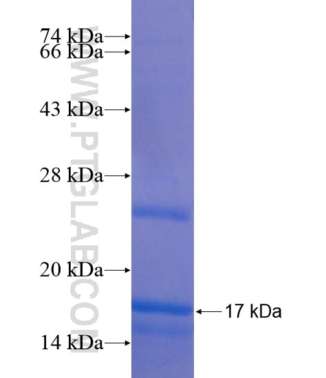 G6PC3 fusion protein Ag21103 SDS-PAGE
