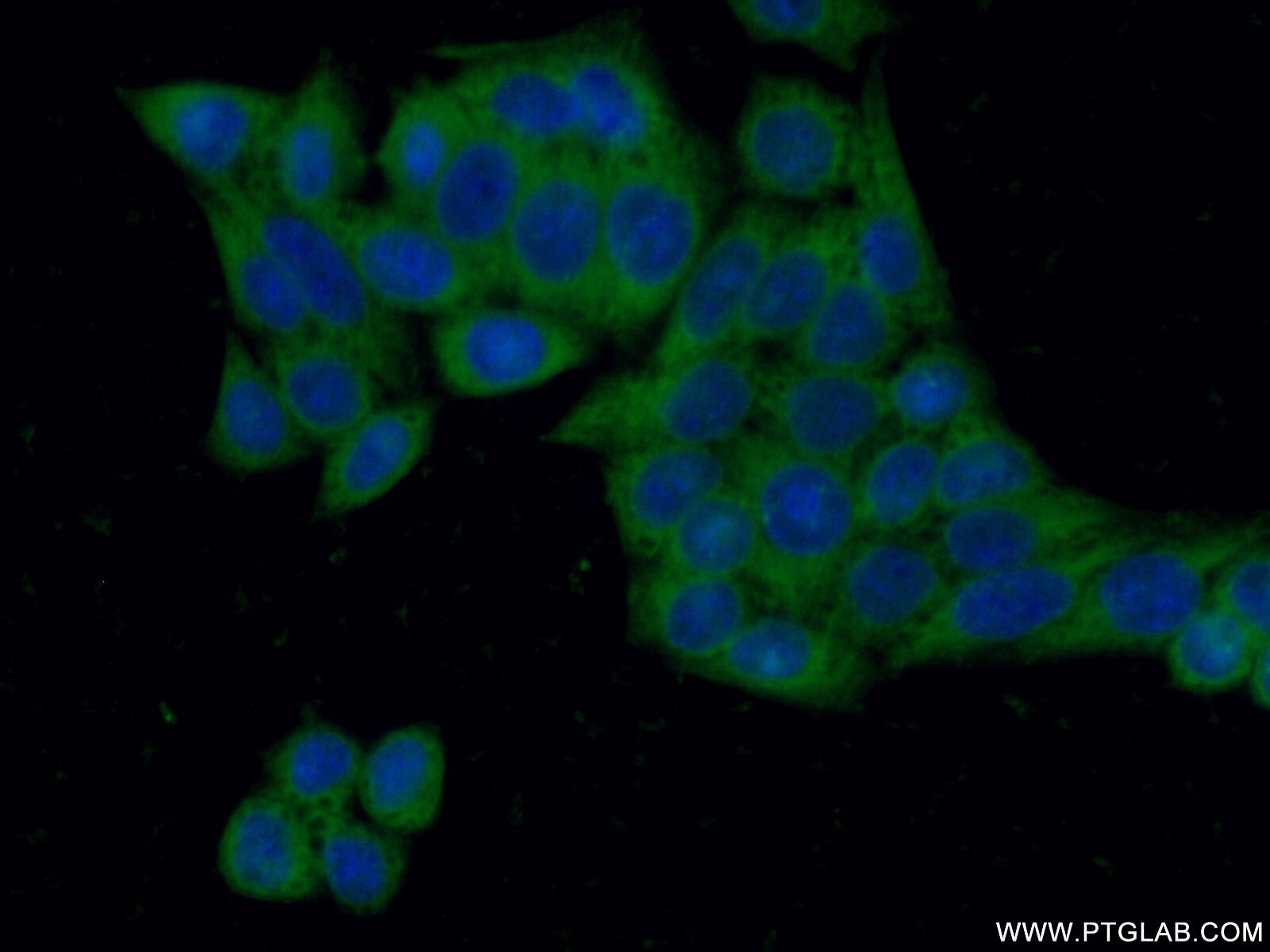 Immunofluorescence (IF) / fluorescent staining of HeLa cells using G6PD Polyclonal antibody (25413-1-AP)