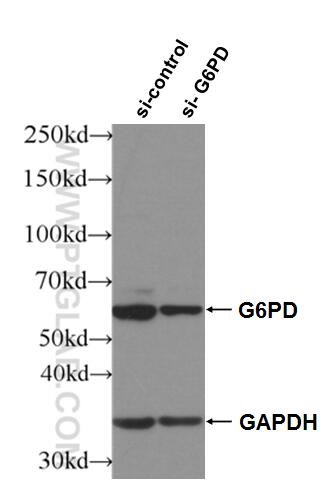 Western Blot (WB) analysis of HeLa cells using G6PD Polyclonal antibody (25413-1-AP)