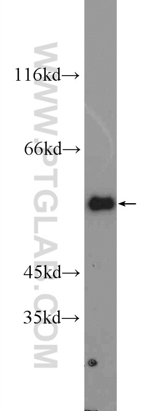 Western Blot (WB) analysis of HeLa cells using G6PD Polyclonal antibody (25413-1-AP)