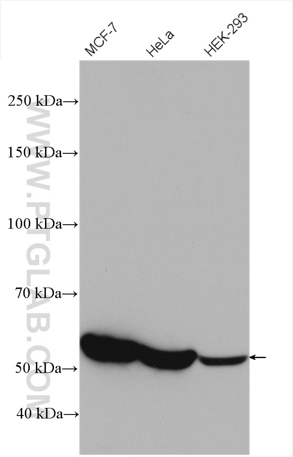 Western Blot (WB) analysis of various lysates using G6PD Polyclonal antibody (25413-1-AP)