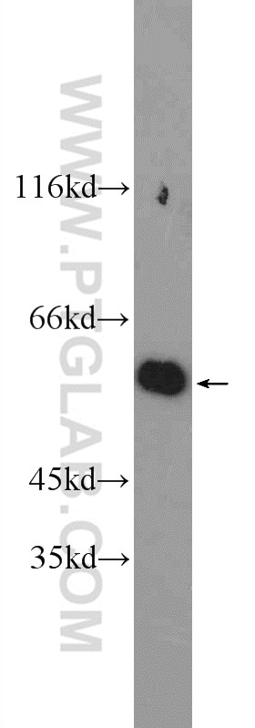 Western Blot (WB) analysis of MCF-7 cells using G6PD Polyclonal antibody (25413-1-AP)