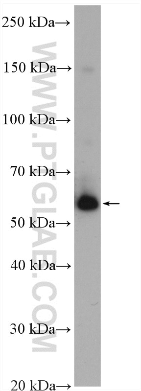 Western Blot (WB) analysis of HeLa cells using G6PD Polyclonal antibody (25413-1-AP)