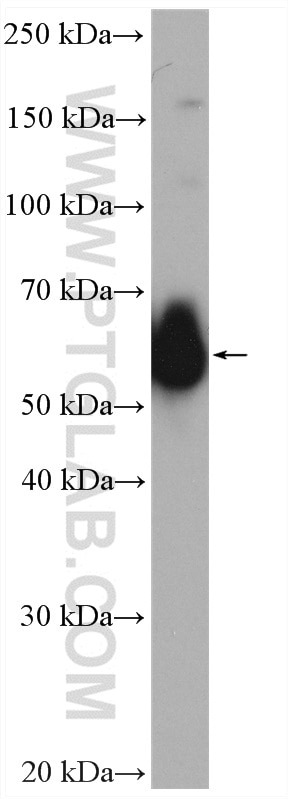 Western Blot (WB) analysis of MCF-7 cells using G6PD Polyclonal antibody (25413-1-AP)