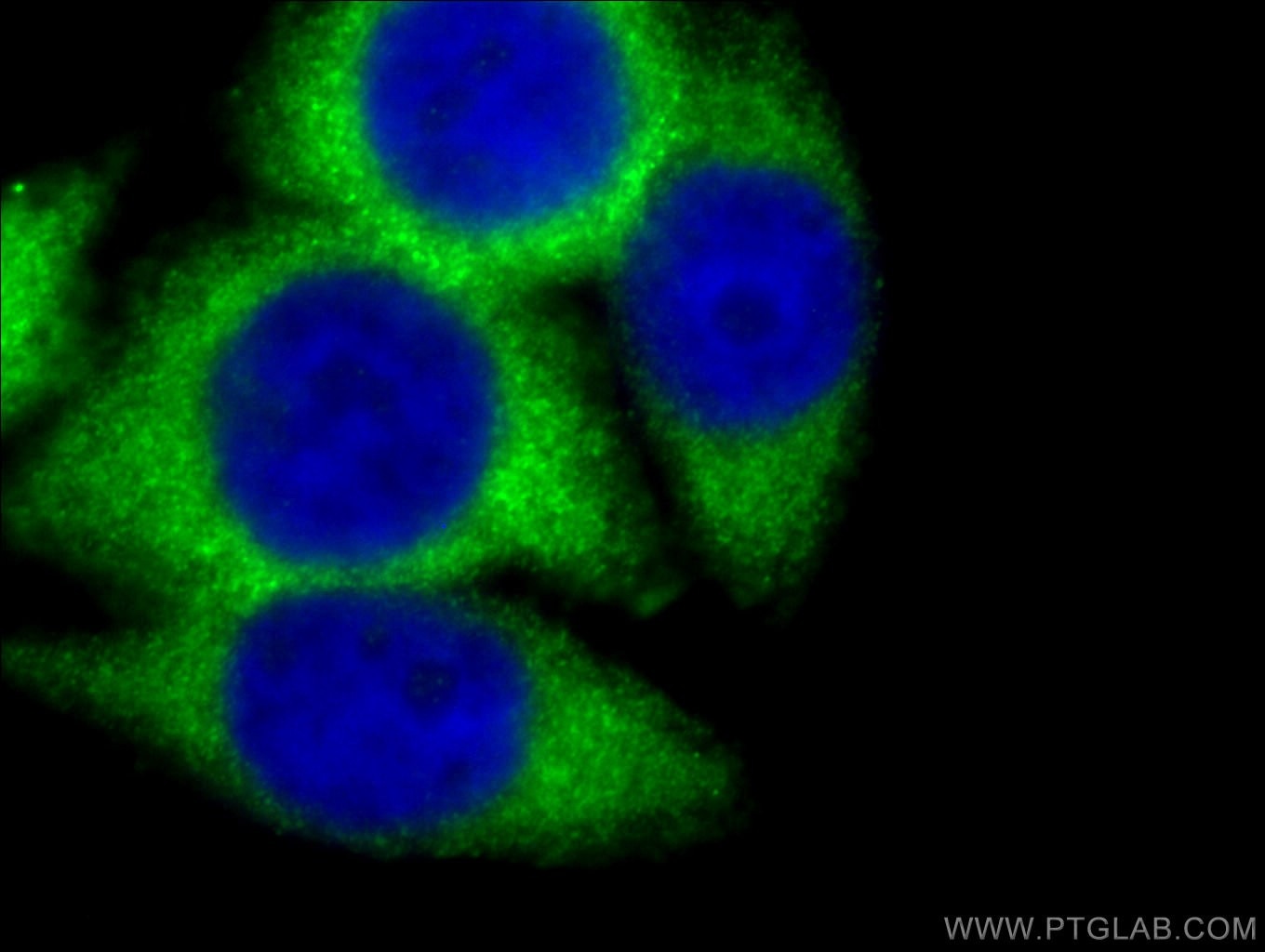 Immunofluorescence (IF) / fluorescent staining of HeLa cells using G6PD Monoclonal antibody (66373-1-Ig)