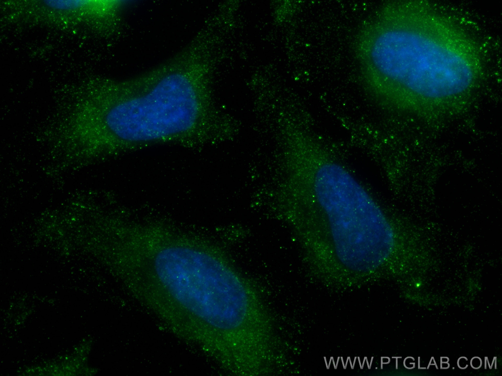 Immunofluorescence (IF) / fluorescent staining of HeLa cells using G6PD Monoclonal antibody (66373-1-Ig)
