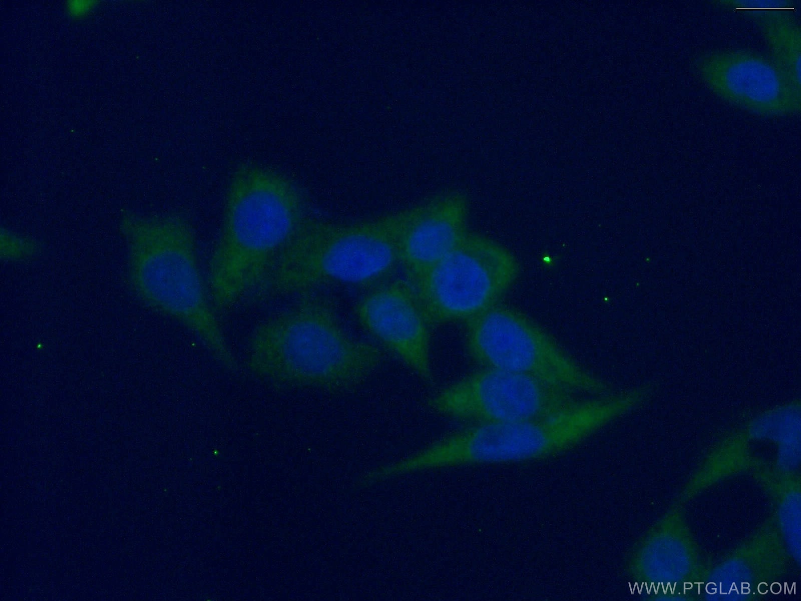 Immunofluorescence (IF) / fluorescent staining of HeLa cells using G6PD Monoclonal antibody (66373-1-Ig)