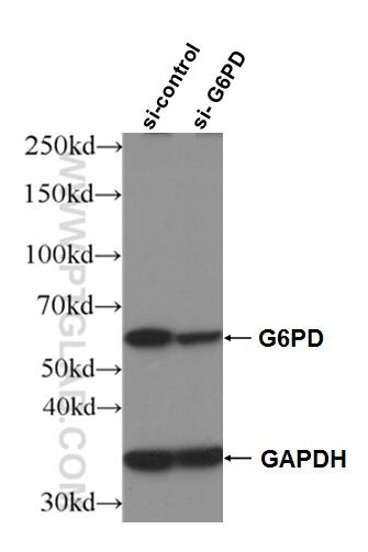 Western Blot (WB) analysis of HeLa cells using G6PD Monoclonal antibody (66373-1-Ig)