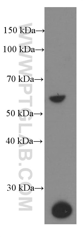 Western Blot (WB) analysis of rat spleen tissue using G6PD Monoclonal antibody (66373-1-Ig)