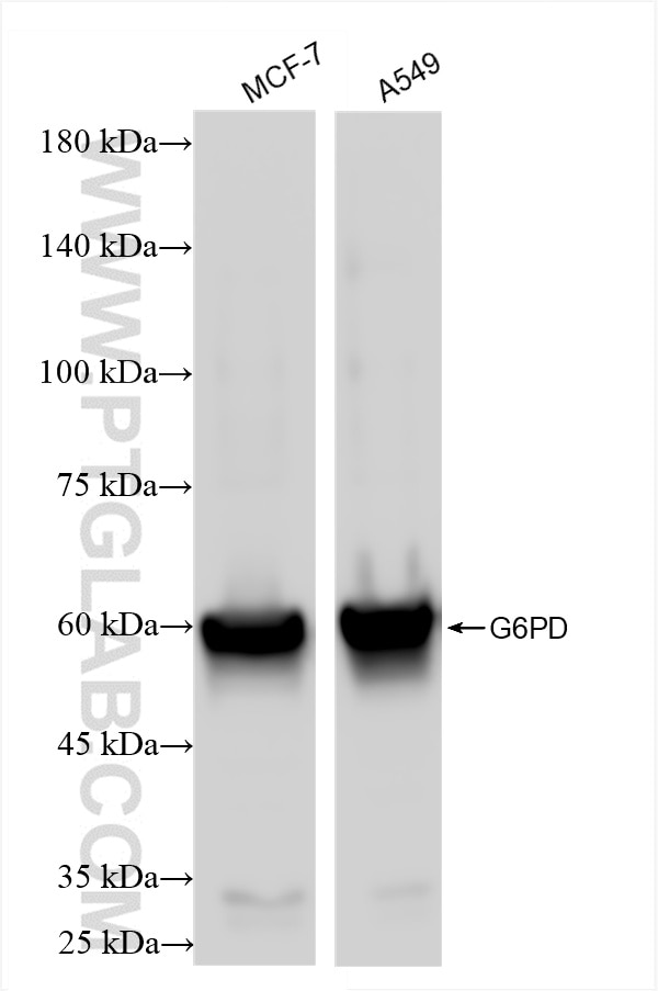 Various lysates were subjected to SDS PAGE followed by western blot with 86240-1-RR (G6PD antibody) at dilution of 1:10000 incubated at room temperature for 1.5 hours. Western Blot (WB) analysis of various lysates using G6PD Recombinant antibody (86240-1-RR)