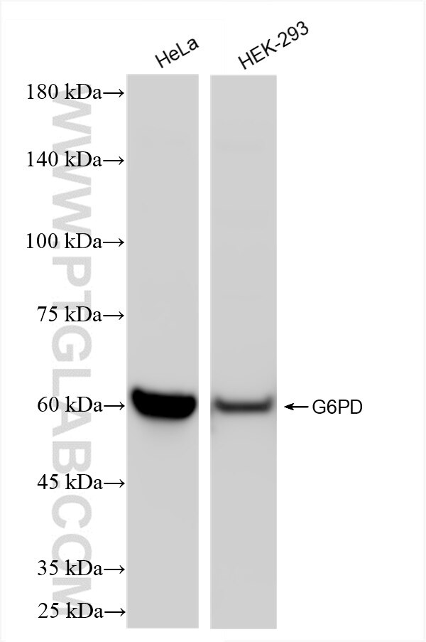Various lysates were subjected to SDS PAGE followed by western blot with 86240-1-RR (G6PD antibody) at dilution of 1:10000 incubated at room temperature for 1.5 hours. Western Blot (WB) analysis of various lysates using G6PD Recombinant antibody (86240-1-RR)