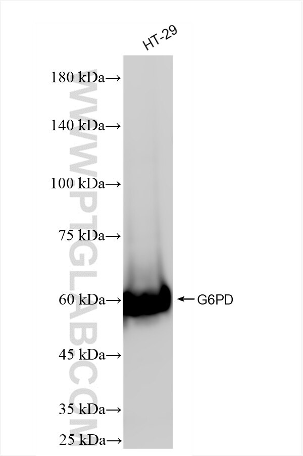 HT-29 cells were subjected to SDS PAGE followed by western blot with 86240-1-RR (G6PD antibody) at dilution of 1:10000 incubated at room temperature for 1.5 hours. Western Blot (WB) analysis of HT-29 cells using G6PD Recombinant antibody (86240-1-RR)