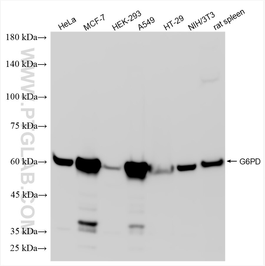 Western Blot (WB) analysis of various lysates using G6PD Recombinant antibody (86240-2-RR)