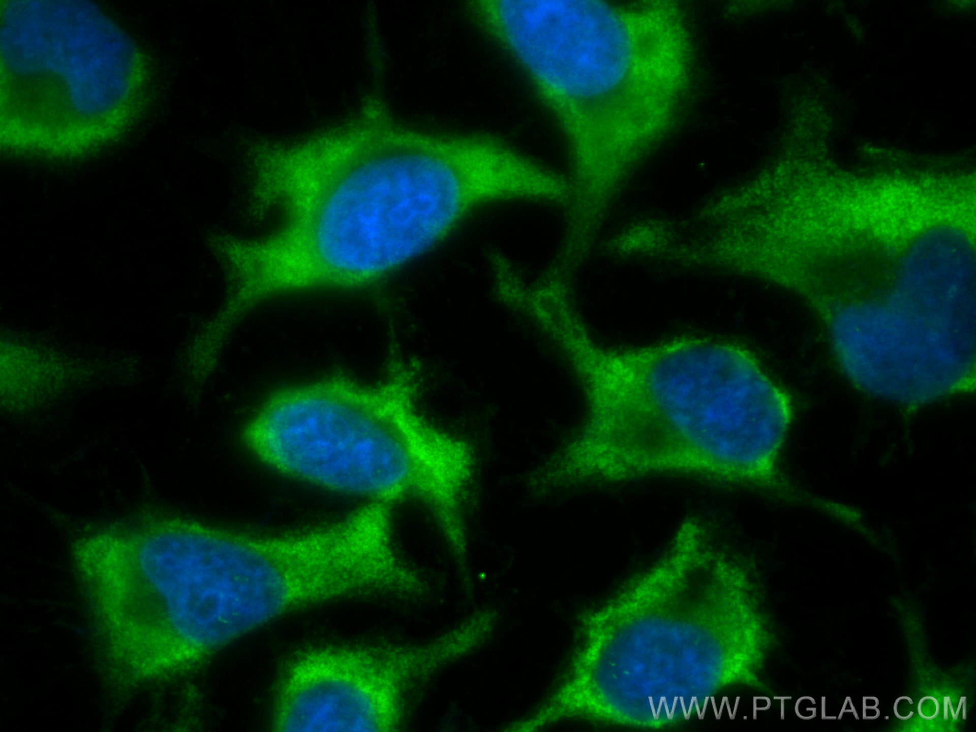 Immunofluorescence (IF) / fluorescent staining of HeLa cells using CoraLite® Plus 488-conjugated G6PD Monoclonal anti (CL488-66373)