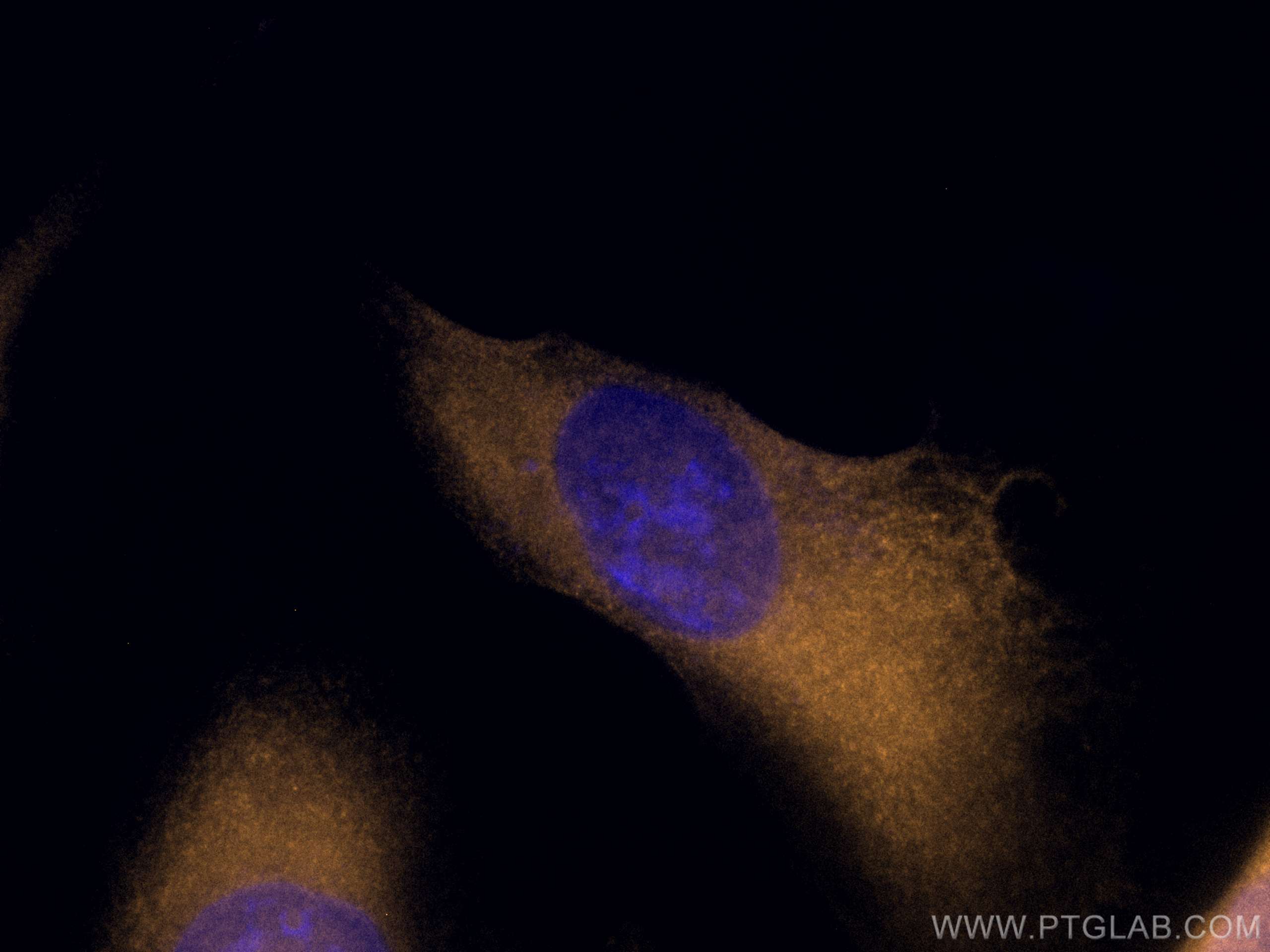 Immunofluorescence (IF) / fluorescent staining of HeLa cells using CoraLite®555-conjugated G6PD Monoclonal antibody (CL555-66373)