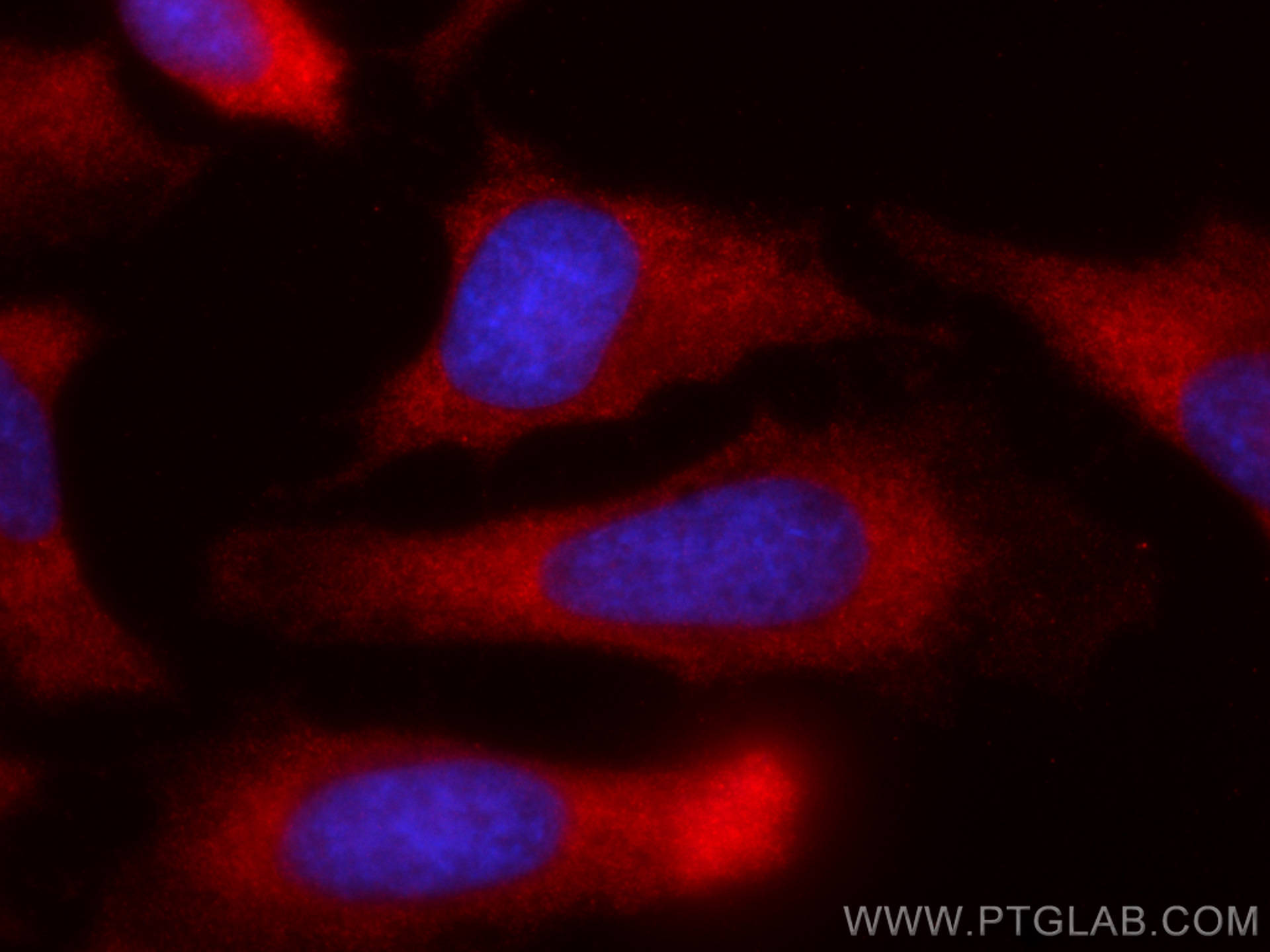 Immunofluorescence (IF) / fluorescent staining of HeLa cells using CoraLite®594-conjugated G6PD Monoclonal antibody (CL594-66373)
