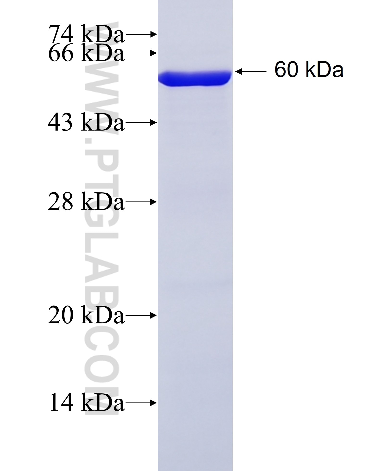 G6PD fusion protein Ag21862 SDS-PAGE