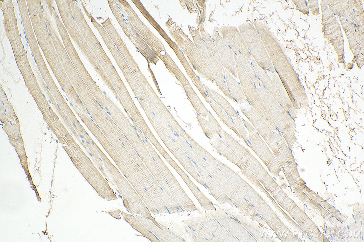 Immunohistochemistry (IHC) staining of mouse skeletal muscle tissue using GAA Polyclonal antibody (14367-1-AP)