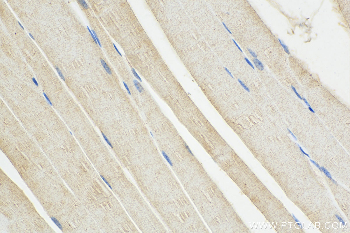 Immunohistochemistry (IHC) staining of mouse skeletal muscle tissue using GAA Polyclonal antibody (14367-1-AP)