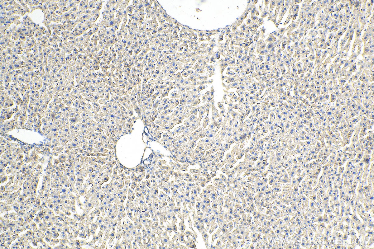 Immunohistochemistry (IHC) staining of mouse liver tissue using GAA Polyclonal antibody (14367-1-AP)