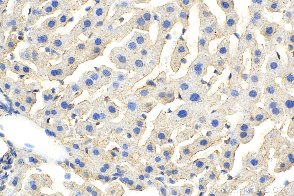 Immunohistochemistry (IHC) staining of mouse liver tissue using GAA Polyclonal antibody (14367-1-AP)