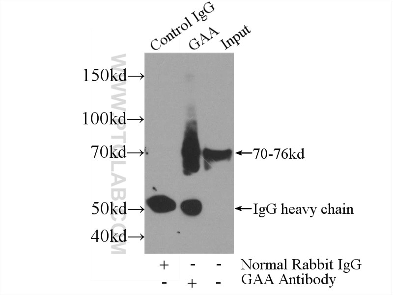 Immunoprecipitation (IP) experiment of mouse liver tissue using GAA Polyclonal antibody (14367-1-AP)