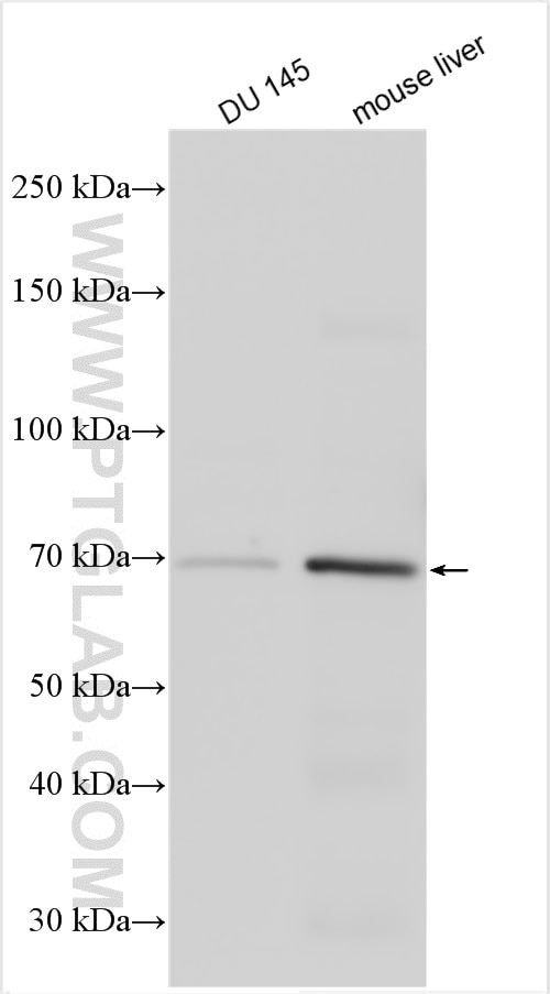 Western Blot (WB) analysis of various lysates using GAA Polyclonal antibody (14367-1-AP)