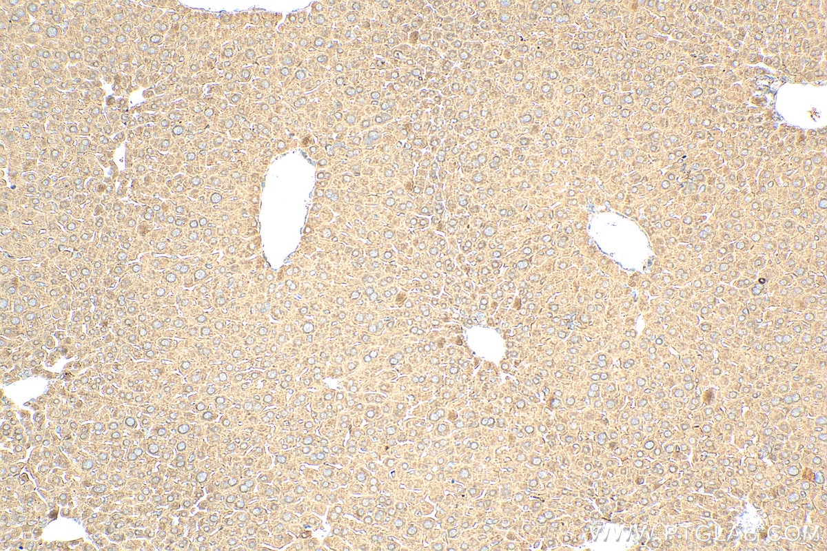 Immunohistochemistry (IHC) staining of mouse liver tissue using GAA Polyclonal antibody (29993-1-AP)