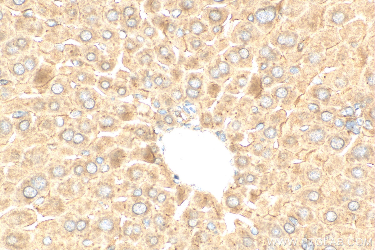 Immunohistochemistry (IHC) staining of mouse liver tissue using GAA Polyclonal antibody (29993-1-AP)
