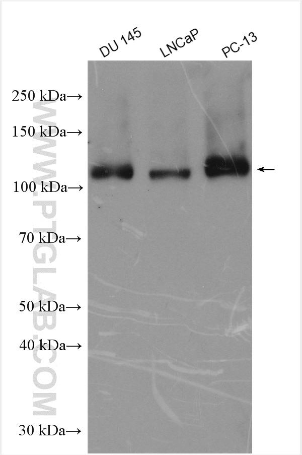 Western Blot (WB) analysis of various lysates using GAA Polyclonal antibody (29993-1-AP)