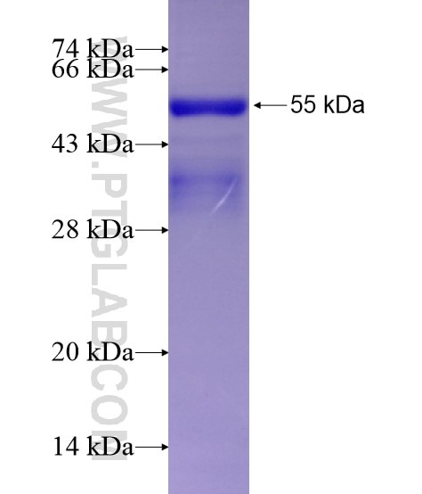 GAA fusion protein Ag28970 SDS-PAGE