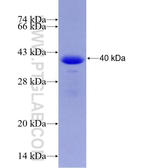 GAA fusion protein Ag7001 SDS-PAGE