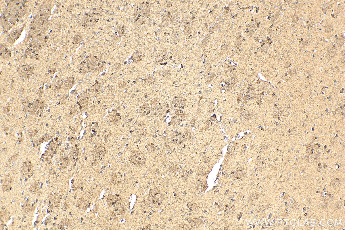 Immunohistochemistry (IHC) staining of mouse brain tissue using GAB1 Polyclonal antibody (26200-1-AP)