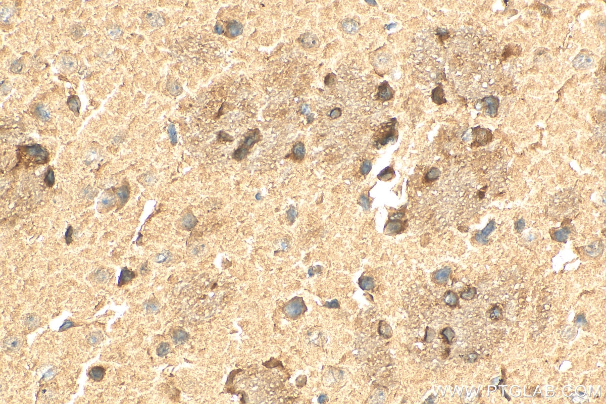 Immunohistochemistry (IHC) staining of mouse brain tissue using GAB1 Polyclonal antibody (26200-1-AP)