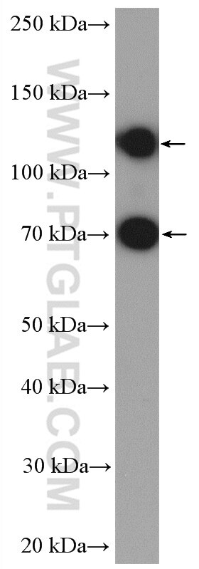 Western Blot (WB) analysis of HEK-293 cells using GAB1 Polyclonal antibody (26200-1-AP)